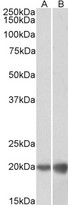 DUT / DUTPase Antibody - DUT / DUTPase antibody (0.1µg/ml) staining of HEK293 (A) and HeLa (B) lysates (35µg protein in RIPA buffer). Detected by chemiluminescence.
