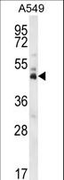 DUX4 Antibody - DUX4 Antibody western blot of A549 cell line lysates (35 ug/lane). The DUX4 antibody detected the DUX4 protein (arrow).