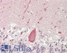 DUX4 Antibody - Human Brain, Cerebellum: Formalin-Fixed, Paraffin-Embedded (FFPE)