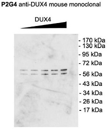 DUX4 Antibody - Western blot using P2B1 anti-DUX4 N-terminus mouse monoclonal on C2C12 cells transfected with pCS2+DUX4 which contains an additional upstream start site.  This image was taken for the unconjugated form of this product. Other forms have not been tested.