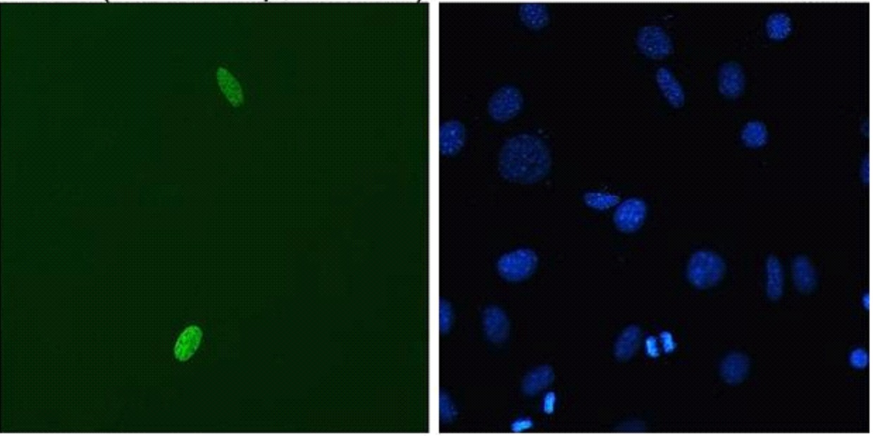 DUX4 Antibody - Immunofluorescent staining using P2B1 mouse monoclonal anti-DUX4 N-terminus on C2C12 myoblasts transfected with pCS2+DUX4. Counter-stained with DAPI for nuclei.  This image was taken for the unconjugated form of this product. Other forms have not been tested.