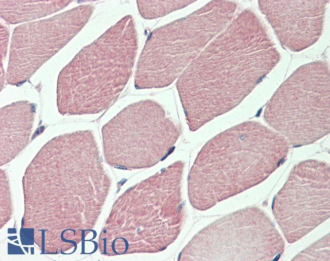 DVL1 / DVL / Dishevelled Antibody - Anti-DVL1 / DVL / Dishevelled antibody IHC staining of human skeletal muscle. Immunohistochemistry of formalin-fixed, paraffin-embedded tissue after heat-induced antigen retrieval.