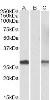 DYDC1 Antibody - Lane A - Goat Anti-DYDC1 (aa142-154) Antibody (1µg/ml) staining of HEK293 overexpressing Human DYDC1 lysate (10µg protein in RIPA buffer) Lane B - Goat Anti-DYDC1 (aa142-154) Antibody (0.1µg/ml) staining of HEK293 mock-transfected lysate (10µg protein in RIPA buffer). Lane C - anti-MYC Tag (1/1000) staining HEK293 overexpressing Human DYDC1 lysate (10µg protein in RIPA buffer). Primary incubations were for 1 hour. Detected by chemiluminescencence.