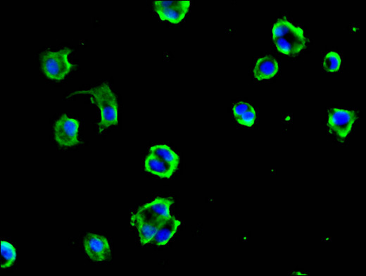 DYNC1H1 Antibody - Immunofluorescent analysis of MCF-7 cells using DYNC1H1 Antibody at a dilution of 1:100 and Alexa Fluor 488-congugated AffiniPure Goat Anti-Rabbit IgG(H+L)