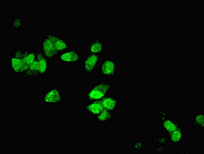 DYNLL1 / PIN Antibody - Immunofluorescent analysis of MCF-7 cells using DYNLL1 Antibody at dilution of 1:100 and Alexa Fluor 488-congugated AffiniPure Goat Anti-Rabbit IgG(H+L)