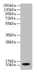 DYNLL1 / PIN Antibody - Western blot All lanes: Dynein light chain 1, cytoplasmic antibody at 2µg/ml + EC109 whole cell lysate Secondary Goat polyclonal to rabbit IgG at 1/15000 dilution Predicted band size: 9.8 kDa Observed band size: 9.8 kDa