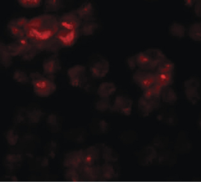 DYRK2 Antibody - Immunofluorescence of DYRK2 in 293 cells with DYRK2 antibody at 20 ug/ml.