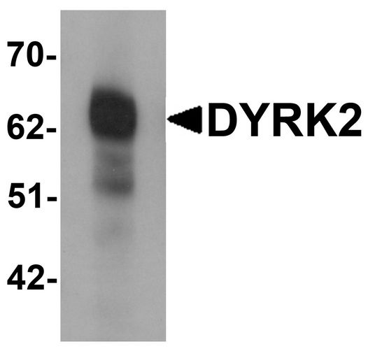 DYRK2 Antibody - Western blot analysis of DYRK2 in 293 cell lysate with DYRK2 antibody at (A) 1 and (B) 2 ug/ml.