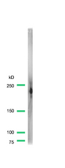 Dysferlin Antibody - Western blot of Dysferlin antibody