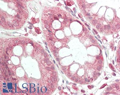 Dystonin / BPAG1 Antibody - Human Colon: Formalin-Fixed, Paraffin-Embedded (FFPE)