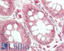 Dystonin / BPAG1 Antibody - Human Colon: Formalin-Fixed, Paraffin-Embedded (FFPE)