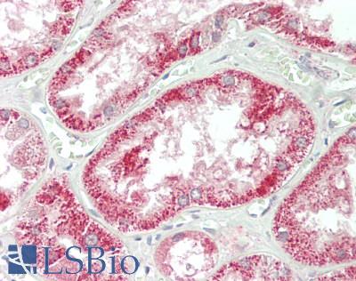 Dystonin / BPAG1 Antibody - Human Kidney: Formalin-Fixed, Paraffin-Embedded (FFPE)