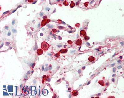 E-FABP / FABP5 Antibody - Human Lung: Formalin-Fixed, Paraffin-Embedded (FFPE)