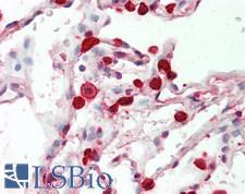 E-FABP / FABP5 Antibody - Human Lung: Formalin-Fixed, Paraffin-Embedded (FFPE)