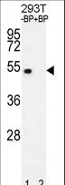 E2F1 Antibody - Western blot of E2F1 Antibody (H357) antibody pre-incubated without(lane 1) and with(lane 2) blocking peptide in 293T cell line lysate. E2F1 Antibody (H357) (arrow) was detected using the purified antibody.
