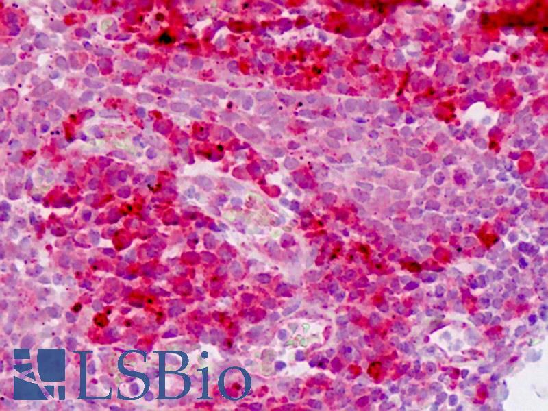 E2F1 Antibody - Human Tonsil: Formalin-Fixed, Paraffin-Embedded (FFPE)