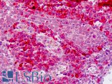 E2F1 Antibody - Human Tonsil: Formalin-Fixed, Paraffin-Embedded (FFPE)