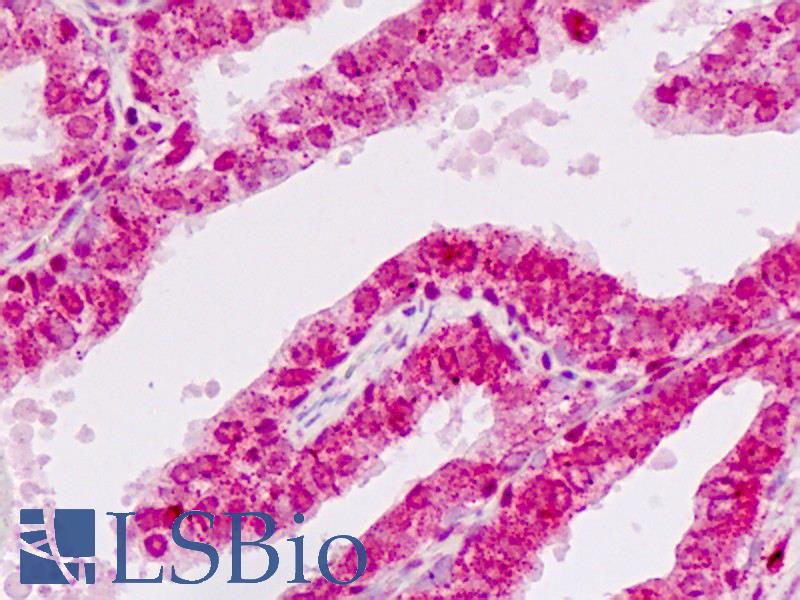 E2F1 Antibody - Human Prostate: Formalin-Fixed, Paraffin-Embedded (FFPE)