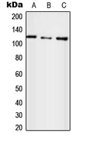 E4 / UBE4A Antibody - Western blot analysis of UBE4A expression in HepG2 (A); SP2/0 (B); H9C2 (C) whole cell lysates.