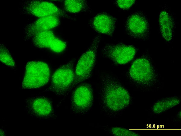 E4F1 / E4F Antibody - Immunofluorescence of monoclonal antibody to E4F1 on HeLa cell . [antibody concentration 10 ug/ml]