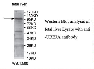 E6AP / UBE3A Antibody