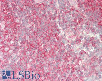 E6AP / UBE3A Antibody - Human Tonsil: Formalin-Fixed, Paraffin-Embedded (FFPE)