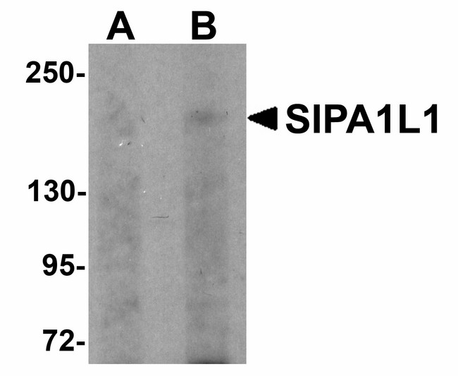E6TP1 / SIPA1L1 Antibody - Western blot of SIPA1L1 in rat brain tissue lysate with SIPA1L1 antibody at (A) 0.5 and (B) 1 ug/ml. 