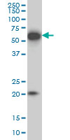 EBF3 / COE3 Antibody - EBF3 monoclonal antibody (M05), clone 8D6 Western blot of EBF3 expression in IMR-32.