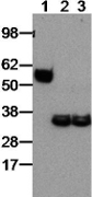 EBI3 / IL-27B Antibody - Recombinant mouse EBI3/p28 (covalently linked IL-27) protein (lane 1) and mouse bone marrow-derived dendritic cells stimulated with LPS (lane 2) or left untreated (lane3) were analyzed by SDS-PAGE followed by immunoblotting with 5 ug/ml of anti-mouse EBI3 (DNT27). Bands were visualized with horseradish peroxidase (HRP)-conjugated goat anti-rat IgG.