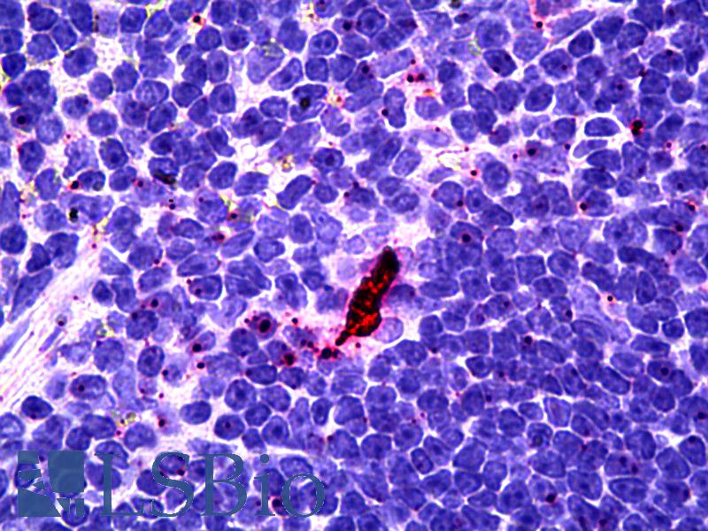 EBI3 / IL-27B Antibody - Anti-EBI3 antibody IHC of human lymphoid-dendritic cells. Immunohistochemistry of formalin-fixed, paraffin-embedded tissue after heat-induced antigen retrieval. Antibody concentration 10 ug/ml.