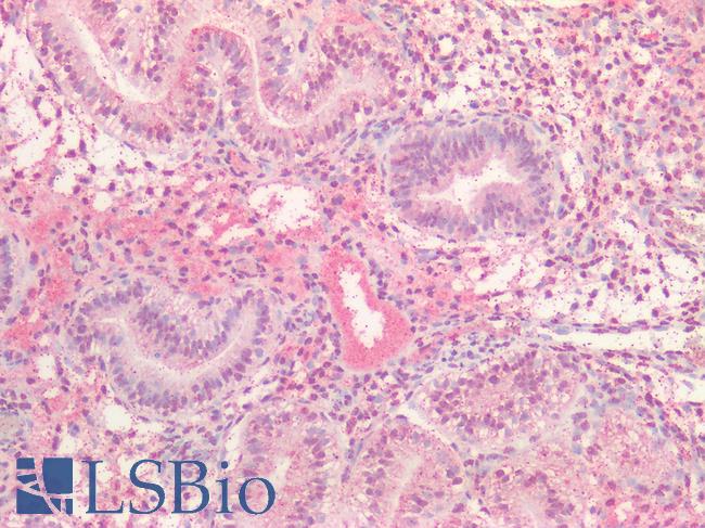 EBI3 / IL-27B Antibody - Human Uterus: Formalin-Fixed, Paraffin-Embedded (FFPE)