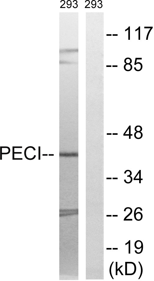 ECI2 / PECI Antibody - Western blot analysis of lysates from 293 cells, using PECI Antibody. The lane on the right is blocked with the synthesized peptide.