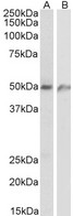 ECSCR Antibody - ECSCR antibody (1 ug/ml) staining of Human lung (A) and Human Umbical cord (B) lysates (35 ug protein in RIPA buffer). Primary incubation was 1 hour.