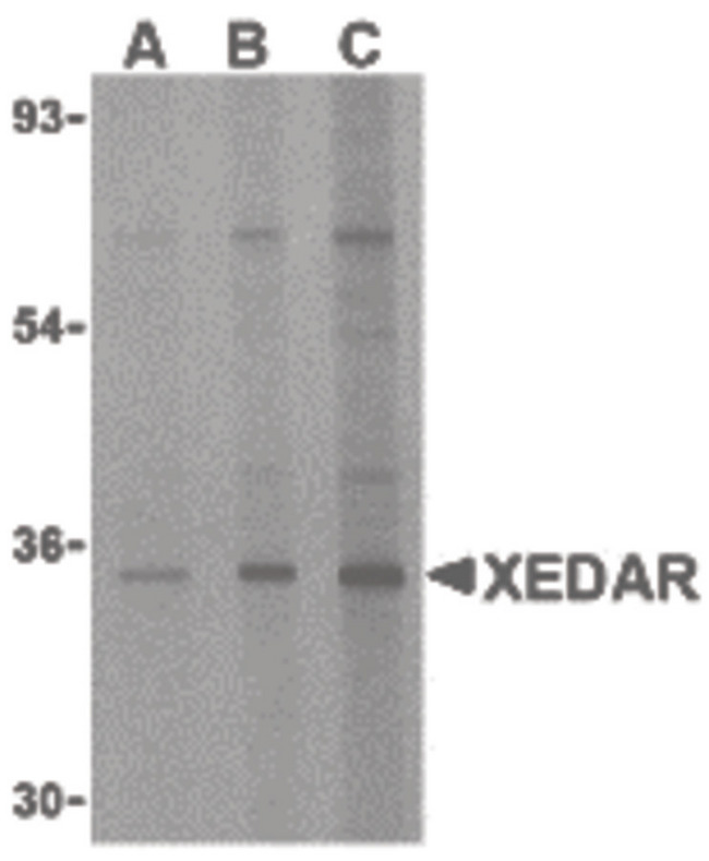 EDA2R / XEDAR Antibody - Western blot of XEDAR in 293 cell lysate with XEDAR antibody at (A) 0.5, (B) 1 and (C) 2 ug/ml.