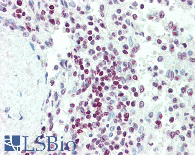 EDF1 / MBF1 Antibody - Anti-EDF1 / MBF1 antibody IHC staining of human spleen. Immunohistochemistry of formalin-fixed, paraffin-embedded tissue after heat-induced antigen retrieval. Antibody concentration 5 ug/ml.
