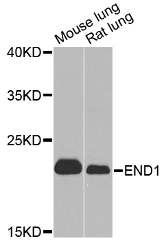 EDN1 / Endothelin 1 Antibody - Western blot analysis of extracts of various cell lines, using EDN1 antibody at 1:1000 dilution. The secondary antibody used was an HRP Goat Anti-Rabbit IgG (H+L) at 1:10000 dilution. Lysates were loaded 25ug per lane and 3% nonfat dry milk in TBST was used for blocking. An ECL Kit was used for detection and the exposure time was 30s.