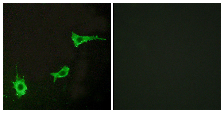 EDNRA / Endothelin A Receptor Antibody - Immunofluorescence analysis of LOVO cells, using EDNRA Antibody. The picture on the right is blocked with the synthesized peptide.
