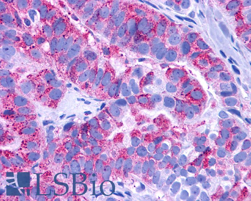 IHC-plus™ EDNRB / Endothelin B Receptor Polyclonal Antibody Biotin | LSBio