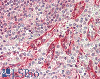 EEA1 Antibody - Human Spleen: Formalin-Fixed, Paraffin-Embedded (FFPE)