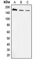 EEA1 Antibody - Western blot analysis of EEA1 expression in A431 (A); HeLa (B); THP1 (C) whole cell lysates.