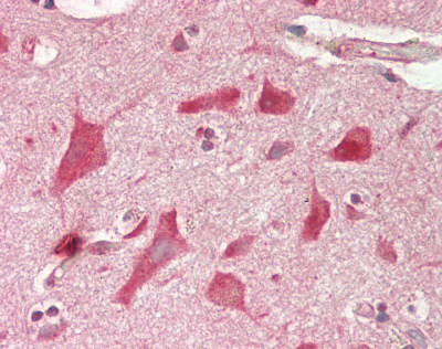 EEA1 Antibody - Human Brain, Cortex: Formalin-Fixed, Paraffin-Embedded (FFPE)