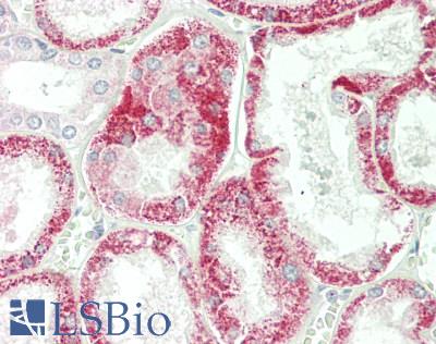 EEF1A1 Antibody - Human Kidney: Formalin-Fixed, Paraffin-Embedded (FFPE)