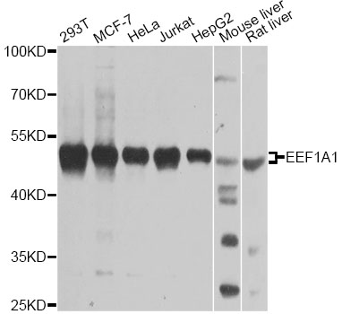 EEF1A1 Antibody - Western blot analysis of extracts of various cell lines, using EEF1A1 antibody at 1:1000 dilution. The secondary antibody used was an HRP Goat Anti-Rabbit IgG (H+L) at 1:10000 dilution. Lysates were loaded 25ug per lane and 3% nonfat dry milk in TBST was used for blocking. An ECL Kit was used for detection and the exposure time was 10s.