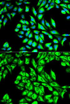 EEF1A1 Antibody - Immunofluorescence analysis of HeLa cells using EEF1A1 antibody. Blue: DAPI for nuclear staining.