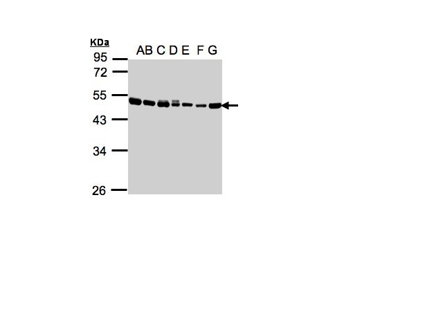 EEF1A2 Antibody - Sample(30g whole cell lysate). A: 293T. B: A431. C: H1299. D: HeLa S3. E: Hep G2. F: MOLT4. G: Raji. 10% SDS PAGE. EEF1A2 antibody diluted at 1:1000
