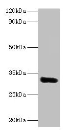 EEF1D Antibody - Western blot All lanes: Elongation factor 1-delta antibody at 2µg/ml + MCF-7 whole cell lysate Secondary Goat polyclonal to rabbit lgG at 1/15000 dilution Predicted band size: 32, 72, 29, 30 kDa Observed band size: 32 kDa