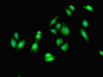 EEF2 / Elongation Factor 2 Antibody - Immunofluorescent analysis of HepG2 cells using EEF2 Antibody at dilution of 1:100 and Alexa Fluor 488-congugated AffiniPure Goat Anti-Rabbit IgG(H+L)
