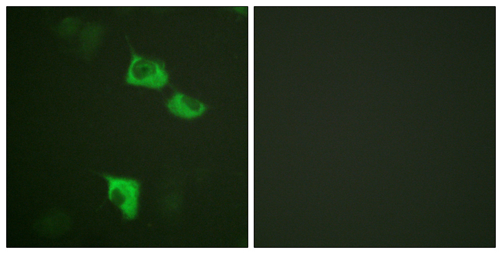 EEF2 / Elongation Factor 2 Antibody - Immunofluorescence analysis of HUVEC cells, using eEF2 Antibody. The picture on the right is blocked with the synthesized peptide.