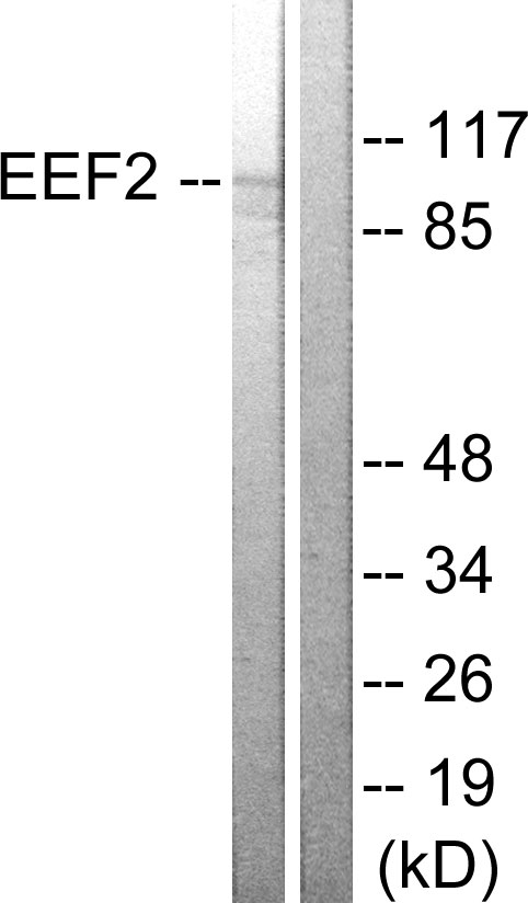 EEF2 / Elongation Factor 2 Antibody - Western blot analysis of lysates from NIH/3T3 cells, treated with serum 10% 30', using eEF2 Antibody. The lane on the right is blocked with the synthesized peptide.