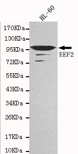 EEF2 / Elongation Factor 2 Antibody - Western blot detection of EEF2 in HL-60 cell lysates using EEF2 antibody (1:1000 diluted).